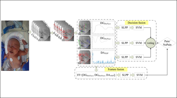 Multimodal Assessment of Neonatal Pain Using Computer Vision