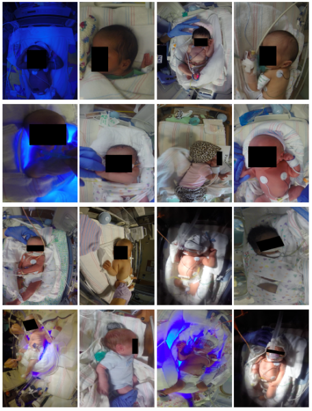 A series of images depicting newborns in a neonatal care unit, highlighting various medical procedures and equipment, including incubators, feeding tubes, and phototherapy lights. All infants are surrounded by medical staff and are being monitored for health conditions.