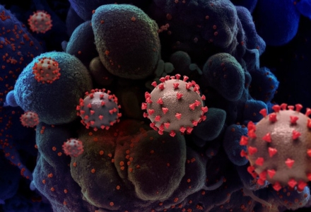 Creative rendering of SARS-COV-2 virus particles. (Photo courtesy of the National Institute of Allergy and Infectious Diseases)