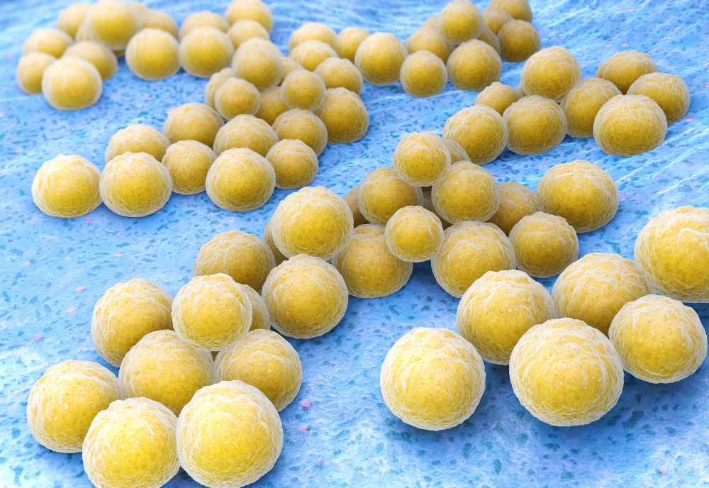 Multi-drug resistant S. aureus superbug. (Photo source: Adobe)