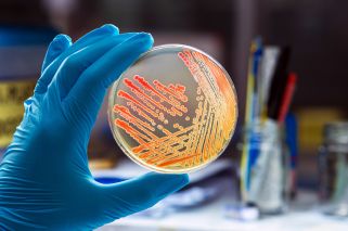 gloved hand holding petri dish with sample