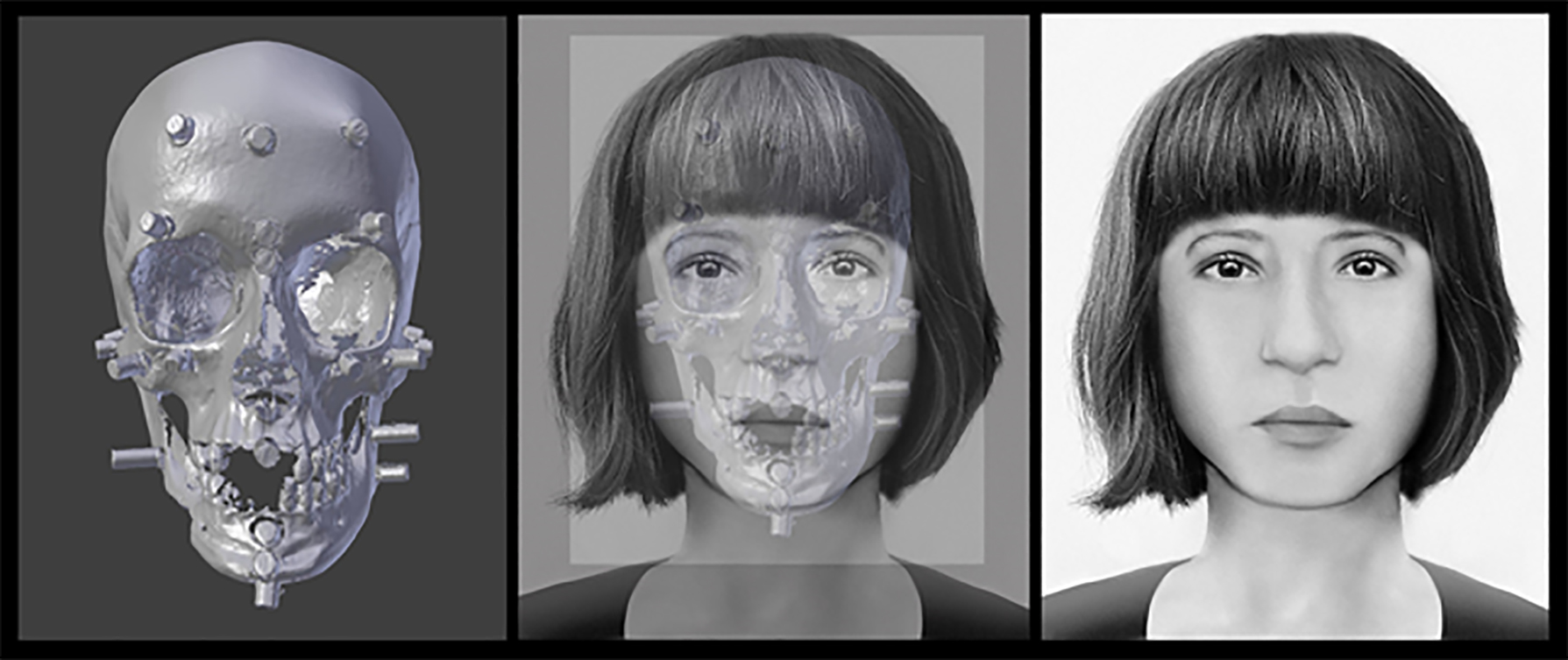 Facial Reconstruction