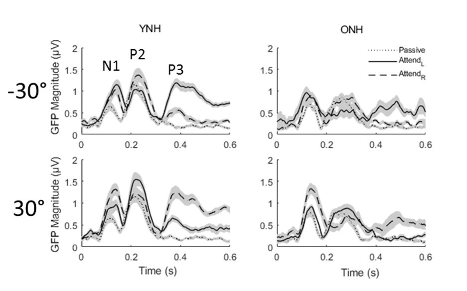 Aging and spatial hearing