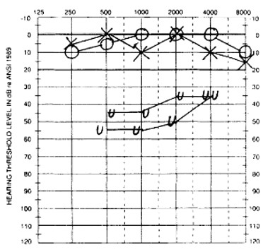 Hyp1