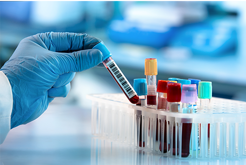vials of blood in a lab setting