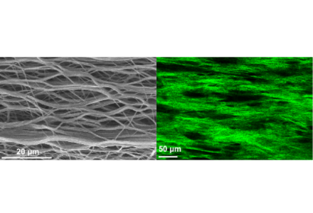 Representative scanning electron microscopy images of an anisotropic electrospun scaffold, accompanied by a second harmonic generation image showing the anisotropic three-dimensional network of aligned collagen fibers embedded within the scaffold's fibers.