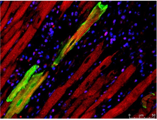 Electrotransfer enhances therapeutic gene delivery to regenerating heart cells-cardiomyocytes.