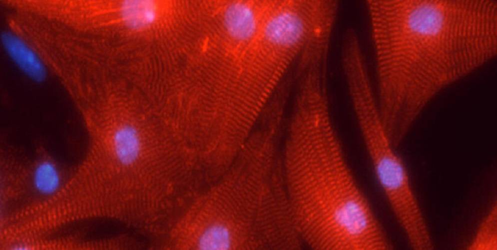 Cardiac cells in the USF Health Heart Institute lab 
