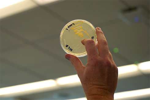 A researcher displays the MRSA bacteria in a petri dish.
