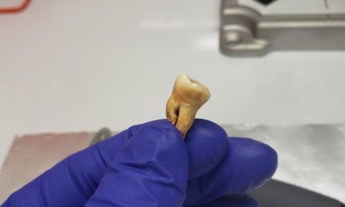 Tooth from Jerash site