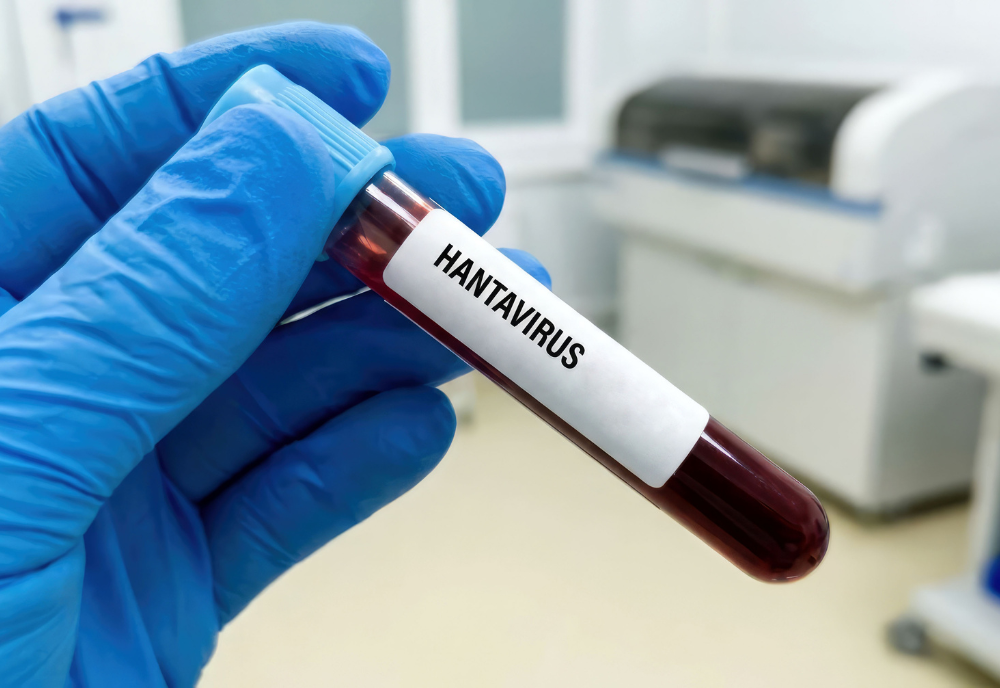 Tube labeled hantavirus
