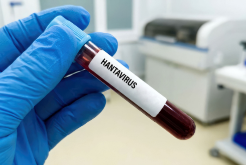 Tube labeled hantavirus