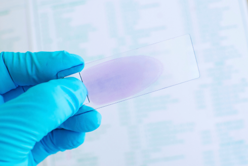 USF Health researchers identify promising vaccine target in malaria parasite