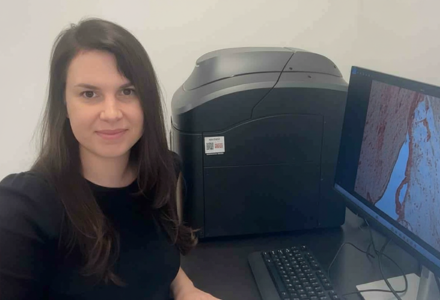 Markoutsa analyzing cellular senescence markers in brain's impacted by Sars-Cov-2