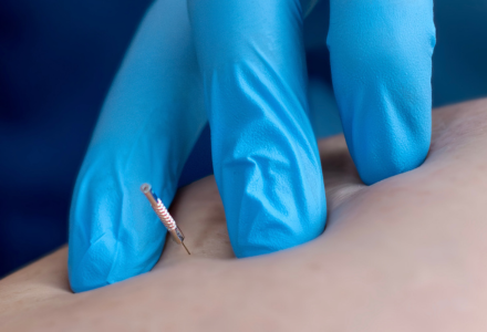 Needle being inserted into a leg