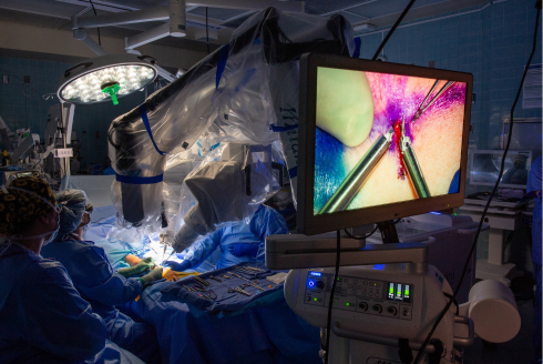 Robotic microsurgery offers new hope for lymphedema patients at USF Health and Tampa General Hospital