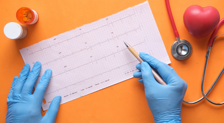 ekg