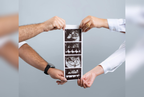 A couple's hands holding up ultrasound scans.