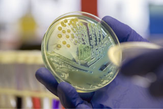 petri dish