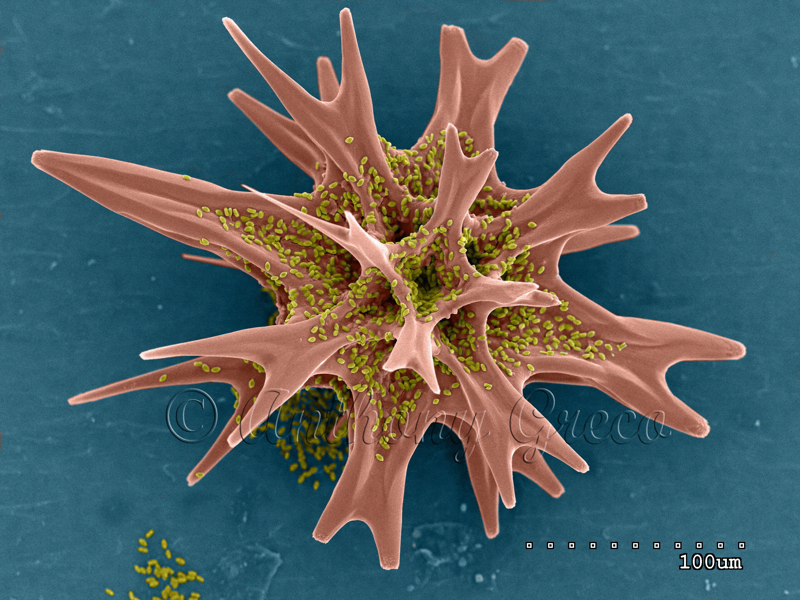 Acantharian