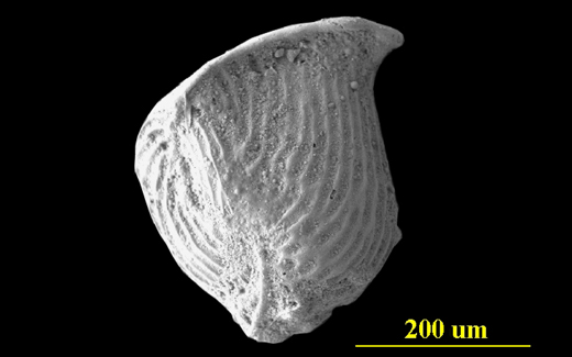 Image - Large with Caption Image Dimensions - Width: 720 px, Height: 400 px* * Recommended Height.   From the Florida Keys, side view, SEM, X200