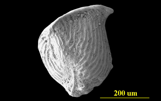 Image - Large with Caption Image Dimensions - Width: 720 px, Height: 400 px* * Recommended Height. From the Florida Keys, side view, SEM, X200