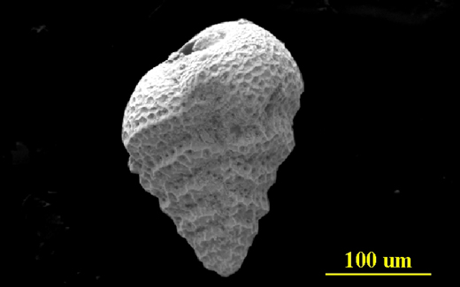 Image - Large with Caption Image Dimensions - Width: 720 px, Height: 400 px* * Recommended Height.   From the Florida Keys, side view, SEM, X300