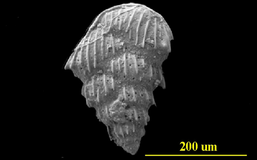 From the Florida Keys, side view, SEM, X250