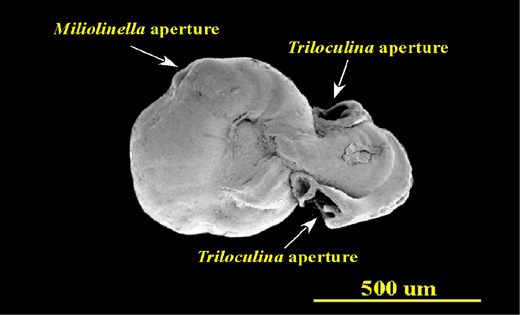 Deformed test from Biscayne Bay, Florida, side view, SEM, X80. This appears to be two seperate Triloculina tests, each with its own aperture and tooth, grown together with a Miliolinella test. The arrows indicate where the apertures are located.