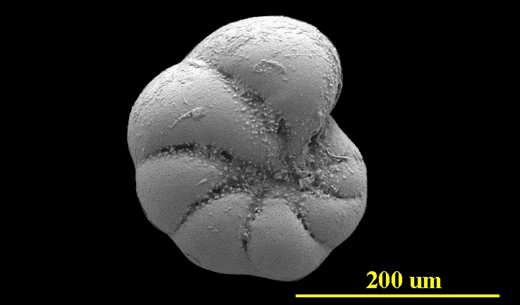From Tampa Bay, Florida, side view, SEM, X250
