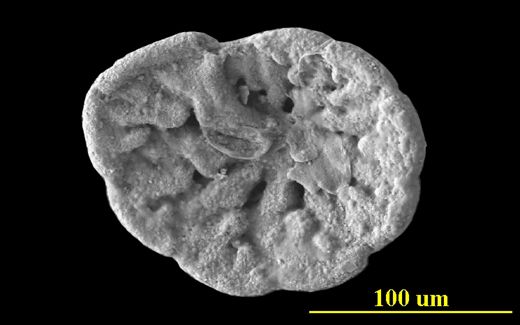 From Tampa Bay, Florida, ventral (apertural) view, SEM, X500