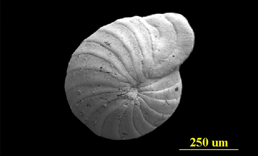 Florida Keys, juvenile side view, SEM, X250