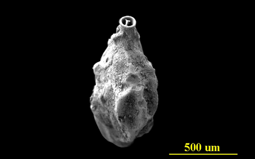 Image - Large with Caption Image Dimensions - Width: 720 px, Height: 400 px* * Recommended Height.   From the Florida Keys, apertural view, SEM, X80