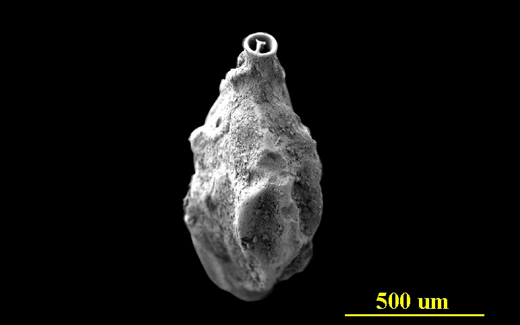 Image - Large with Caption Image Dimensions - Width: 720 px, Height: 400 px* * Recommended Height. From the Florida Keys, apertural view, SEM, X80