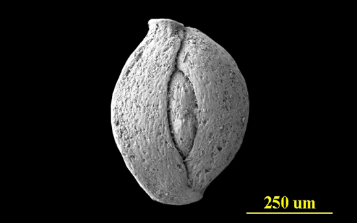 From the Florida Keys, side view, SEM, X120