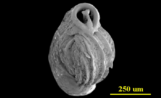 From the Florida Keys, apertural view, SEM, X120