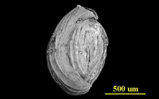 From the Florida Keys, side view, SEM, X60