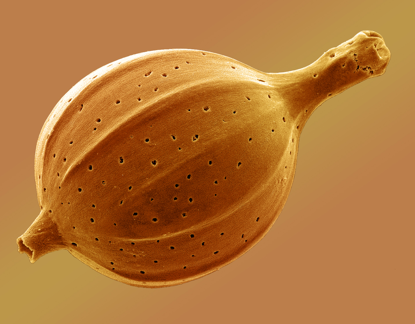 An SEM image of Lagena sulcata, a marine foraminifera. (Photo Credit: Tony Greco)