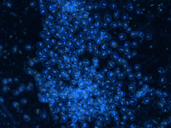 Individual cells of red Noctiluca scintillans seen glowing blue under a microscope. The organism’s balloon-shaped bodies give them the buoyancy to float on the sea surface where humans can observe them. Credit: Sheng-Fang Tsai, National Taiwan Ocean University
