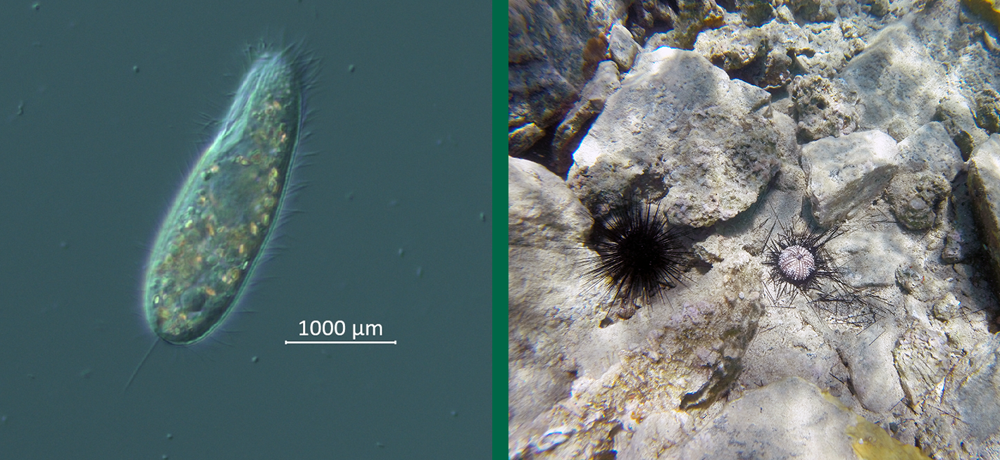 First image - Ciliate culture viewed under the microscope. Image credit, Makenzie Kerr USF College of Marine Science. Second image - DaSc-affected sea urchin (right) and grossly normal sea urchin (left), St John, April 2022. Image credit, Ian Hewson Cornell University.