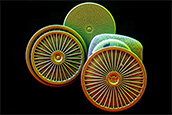 Coloured electron microscopy of diatoms, species Arachnoidiscus ZEISS EVO SEM