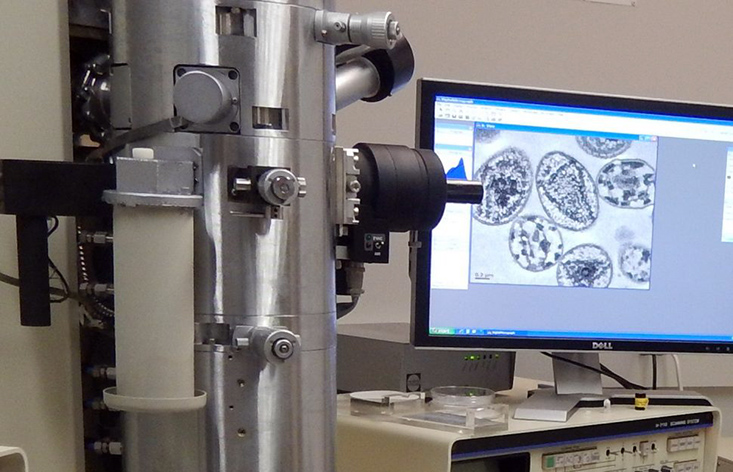 The transmission electron microscope, or TEM, and scanning electron microscope, or SEM.