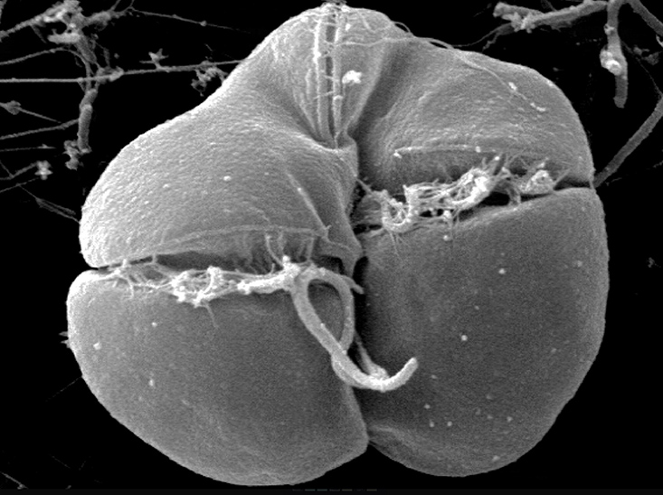 Karenia brevis (scanning electron micrograph)