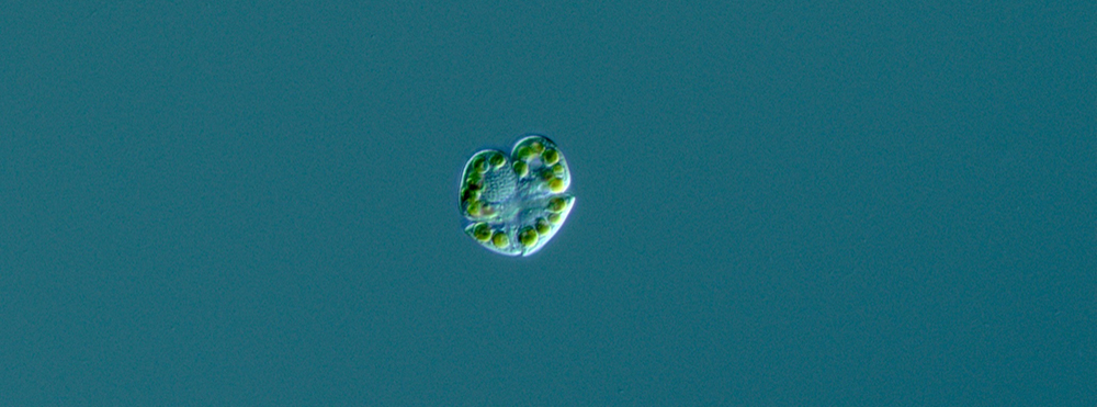 A microscopic image of Karenia brevis, the single-celled organism responsible for red tide. Image courtesy of Mya Breitbart.