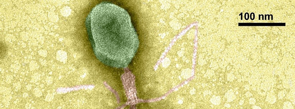 The research will look at molecules called siderophores and viruses called phages, which infect bacteria. The phage shown here was imaged by Anthony M. Greco at the USF College of Marine Science.