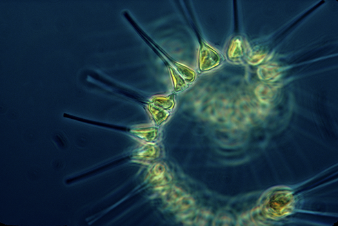 Plankton, such as these chain-forming diatoms, have outsized positive impacts on the planet, according to a new paper that explores the value of these organisms. Credit: NOAA.