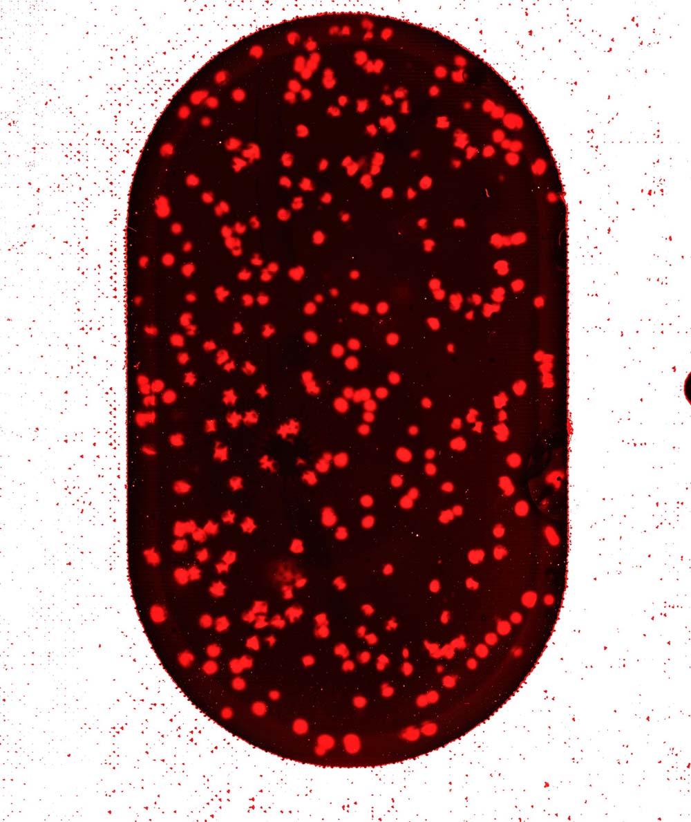 Example polonies that Sawaya and her colleagues observed in the lab. 