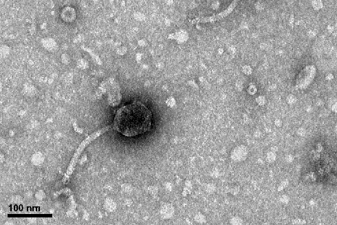 Transmission electron micrograph of a phage that infects a marine bacterium called Vibrio natriegens, an emerging model organism for marine lab studies. Under Breitbart’s mentorship, Yonas described the genome, which he reported in Microbiology Resource Announcements.