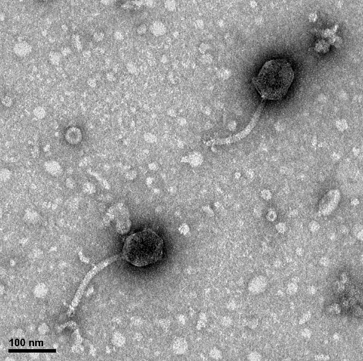 Transmission electron micrograph of a phage that infects a marine bacterium called Vibrio natriegens, an emerging model organism for marine lab studies. Under Breitbart’s mentorship, Yonas described the genome, which he reported in Microbiology Resource Announcements.