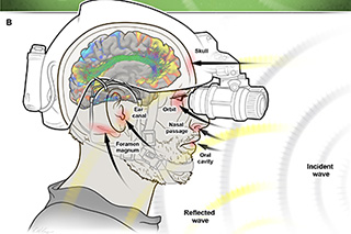 Sketch of a soldier with brain injuries